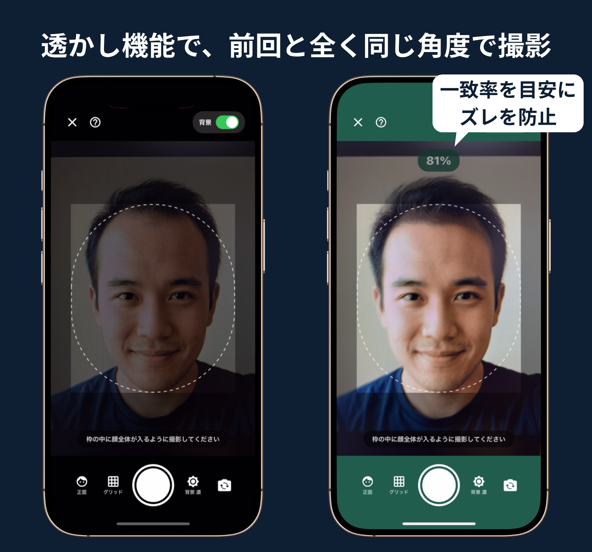 ヘアカム アプリ画面 - 透かし機能で前回と同じ角度で撮影、一致率を目安にズレを防止